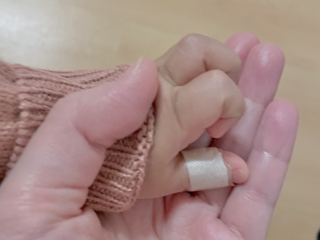 怪我した赤ちゃんの指